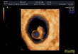 3D начална бременост на 6 седм. и 3 дни